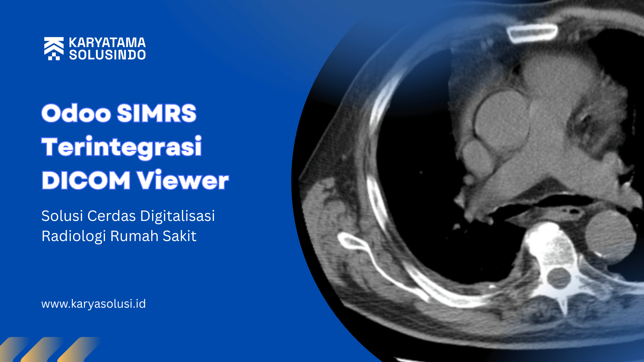 Odoo SIMRS Terintegrasi DICOM Viewer